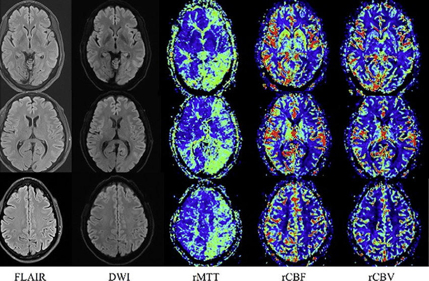 Perfusion software overview